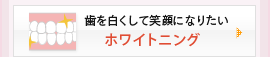 歯を白くして笑顔になりたい：ホワイトニング