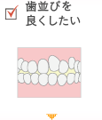 歯並びを良くしたい