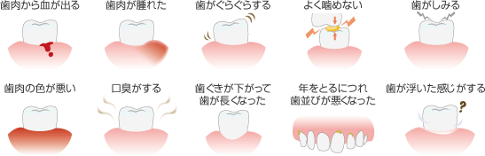 歯周病の症状